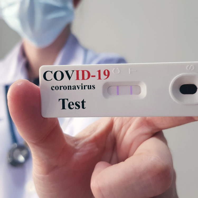 covid teszt